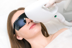 عکس اپیلاسیون صورت زنانه با دستگاه